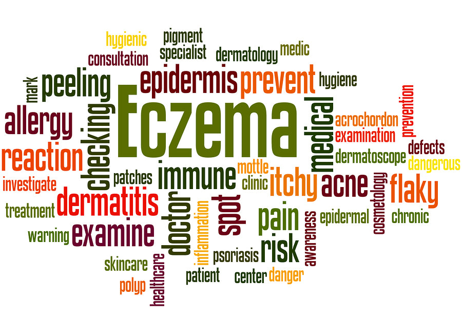 My Battle With Eczema Part I